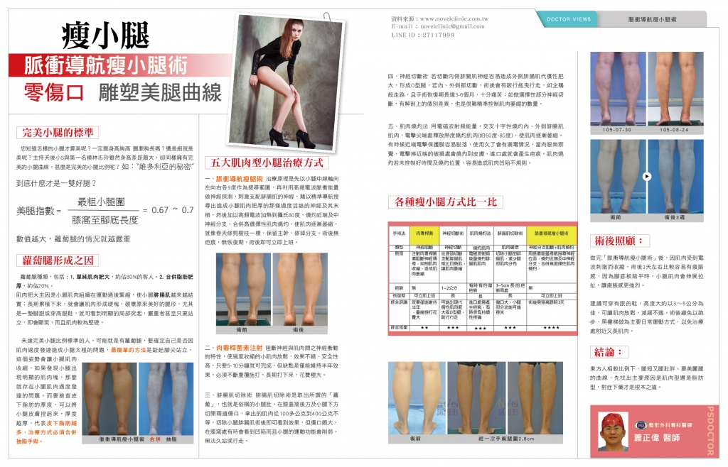 脈衝導航瘦小腿術